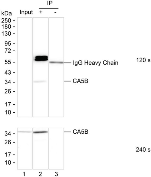 Anti-CA5B