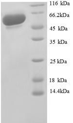 Glyceraldehyde-3-phosphate dehydrogenase (GAPDH), partial, recombinant human