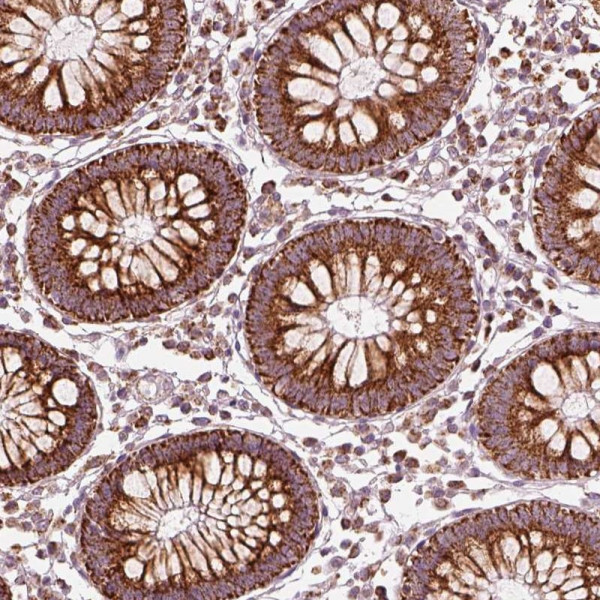 Anti-ENTPD6