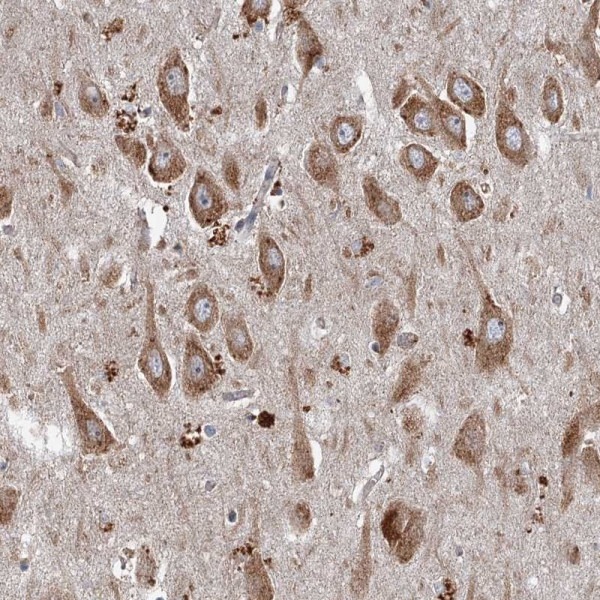 Anti-SRPX2