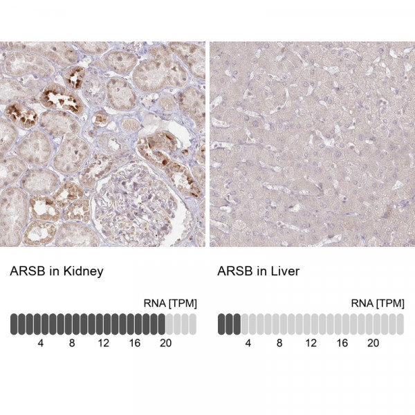 Anti-ARSB