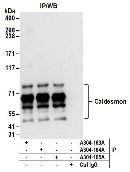 Anti-Caldesmon