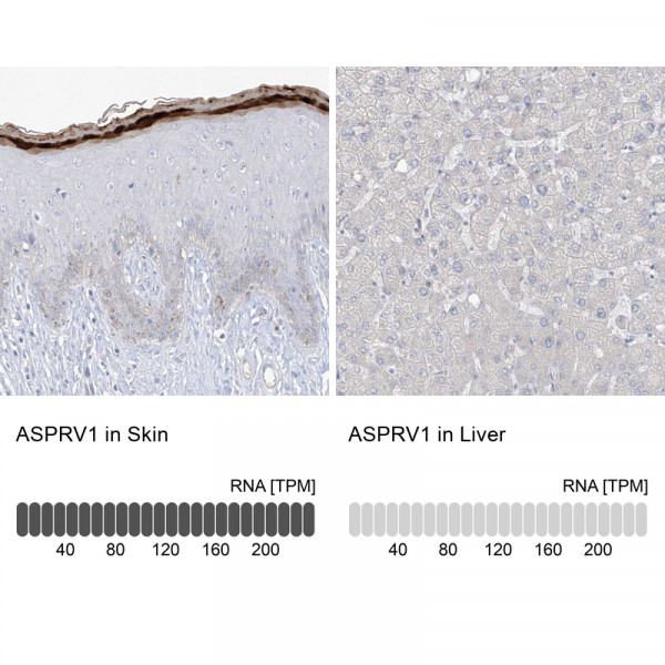 Anti-ASPRV1