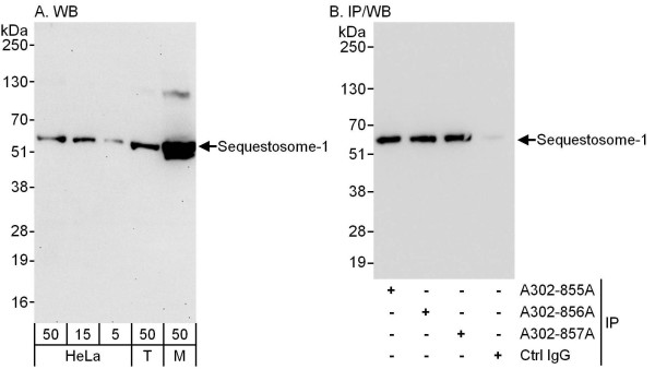 Anti-Sequestosome-1