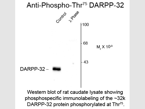 Anti-phospho-DARPP-32 (Thr75)