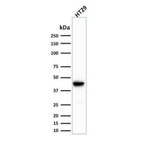 Anti-Cytokeratin 20 / CK20, clone SPM191