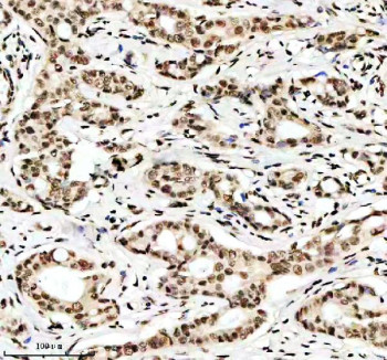 Anti-Histone H3 (acetyl K9) / HIST1H3A, clone 32H22