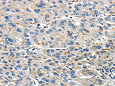 Anti-IQGAP2