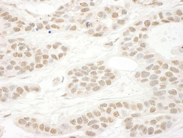Anti-FUSIP1 (IHC)
