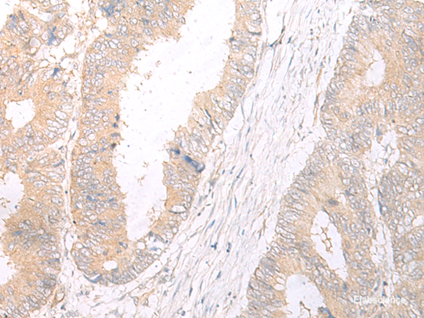 Anti-HLA-C