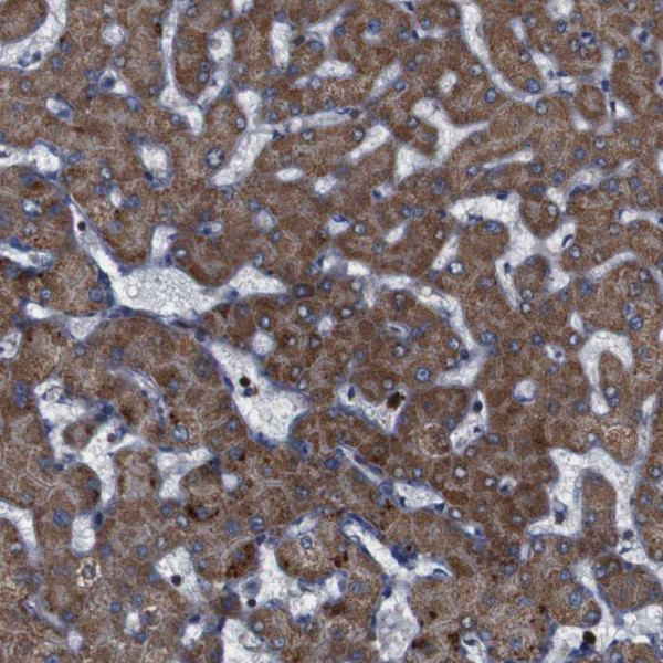 Anti-ATP7B