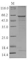 Cathepsin O (CTSO), human, recombinant