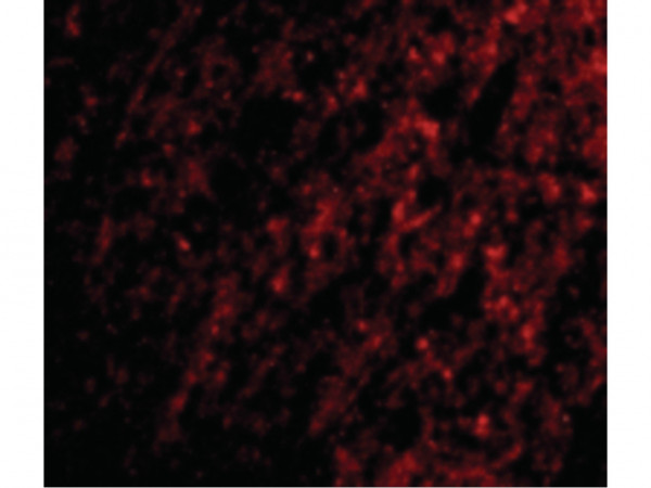 Anti-ATG12