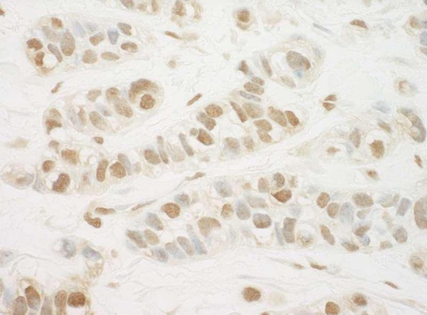Anti-MED13L (IHC)