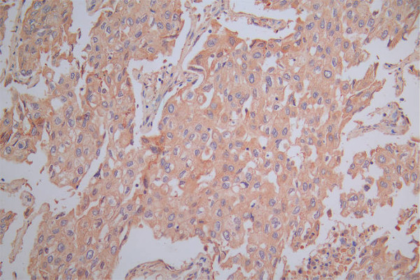 Anti-SLAMF7 Recombinant Monoclonal, clone 7H1