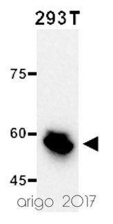 Anti-Vimentin, clone SQab1859