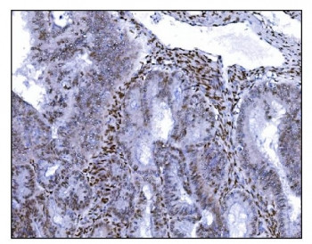 Anti-SRF / Serum Response Factor
