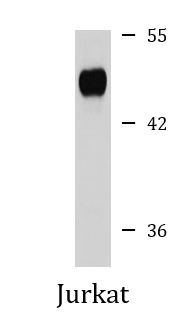 Anti-eIF4A3