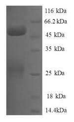 Negative elongation factor B (NELFB), partial, human, recombinant