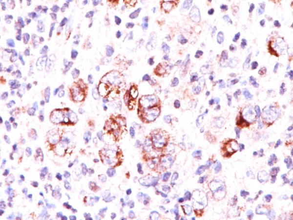 Anti-Bcl-X (Apoptosis Marker), clone 2H12