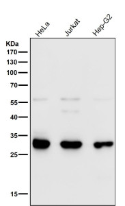 Anti-VAPA / Vesicle-associated membrane protein-associated protein A, clone 32V29