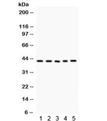 Anti-CCN1