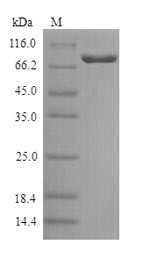 Galactocerebrosidase (GALC), human, recombinant