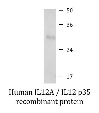 Human IL12A / IL12 p35 recombinant protein (Active)