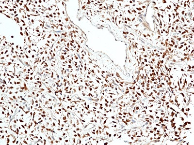 Anti-Stat6, Rabbit Monoclonal (RM473)