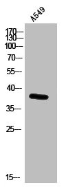 Anti-RXFP4