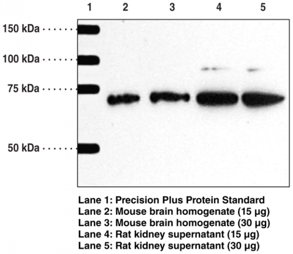 Anti-Serine Palmitoyltransferase
