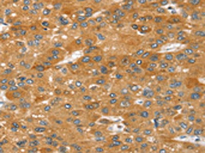 Anti-SRGAP2