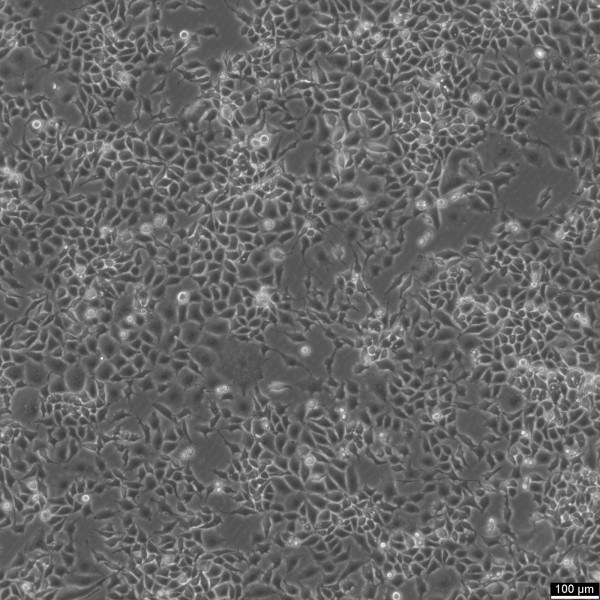 RKO-E6 Cells