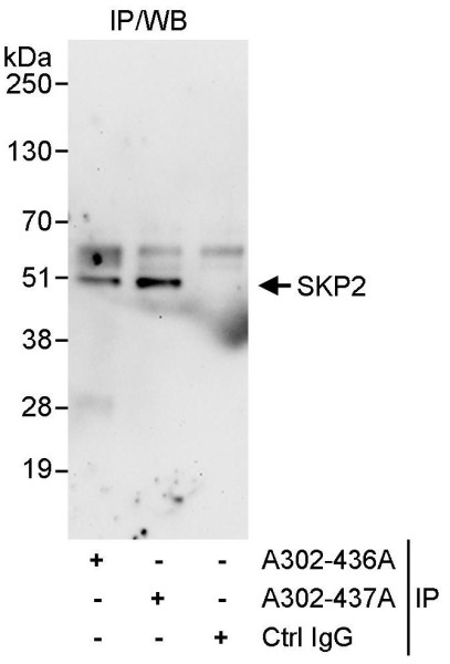Anti-SKP2