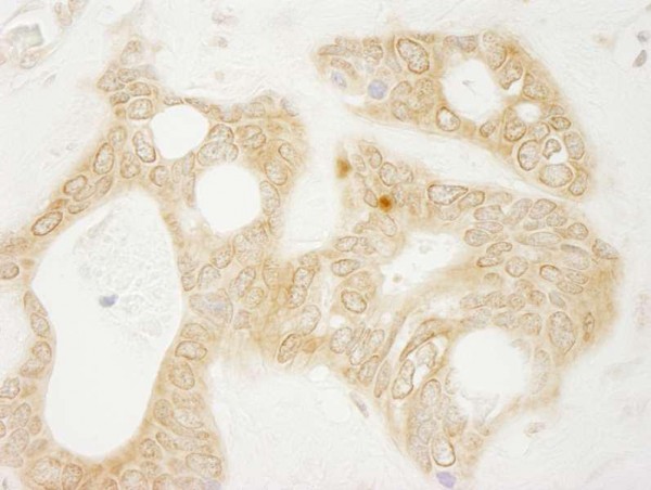 Anti-vPARP (IHC)