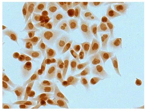 Anti-Mouse IgG2b (HRP), pre-adsorbed [Goat]