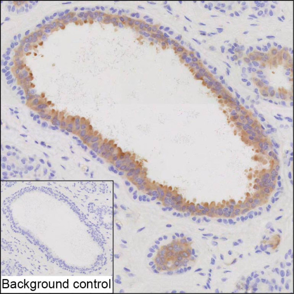 Anti-INPP4B
