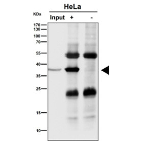 Anti-NMI / N myc and STAT interactor, clone 30N95
