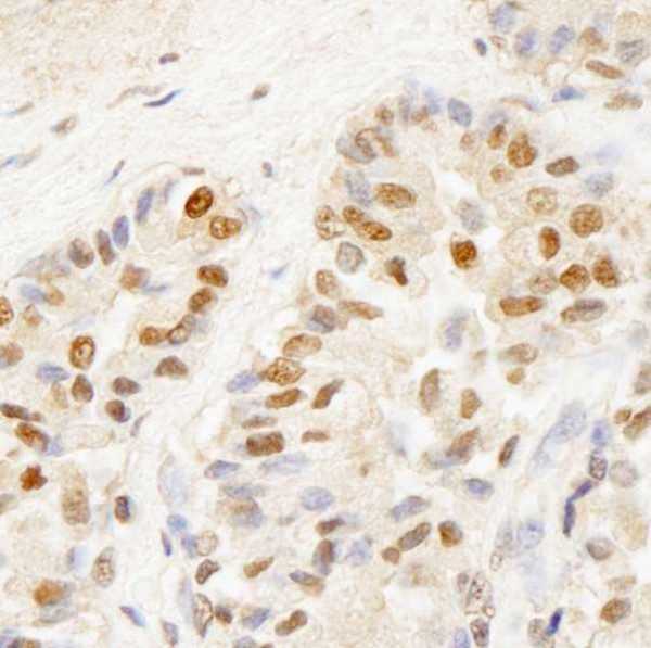 Anti-BRF1 (IHC)