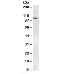 Anti-TRPC6