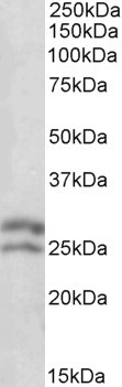 Anti-BCL2, N-terminal