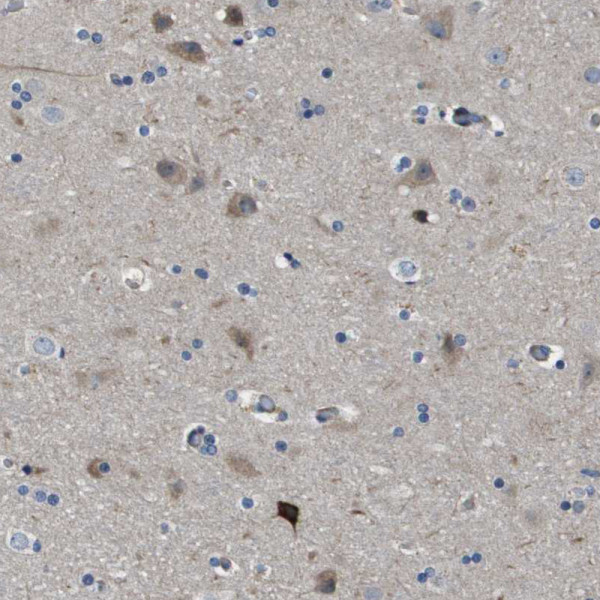 Anti-SCN4B