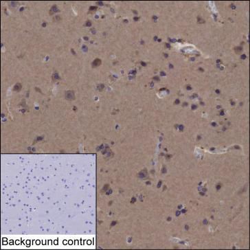 Anti-HMGCR