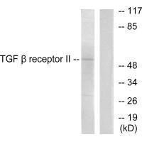 Anti-TGFBR2