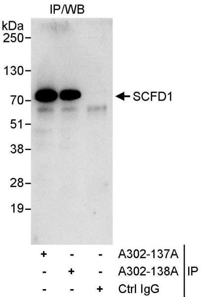 Anti-SCFD1