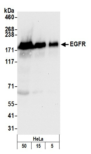 Anti-EGFR