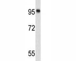 Anti-Nucleolin, clone 130CT43.8.5