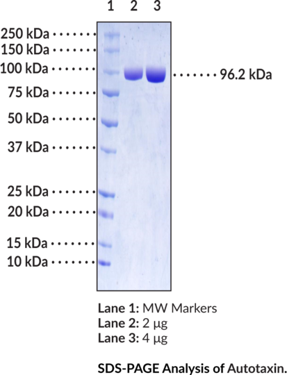 Autotaxin (human, recombinant, mammalian expressed)
