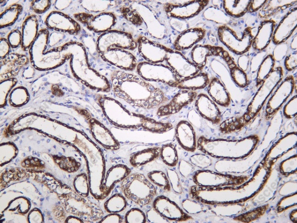 Anti-Recombinant FH, clone C112343