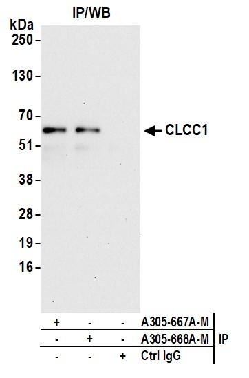 Anti-CLCC1